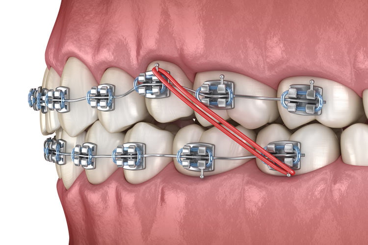 ارتودنسی دندان چیست ؟